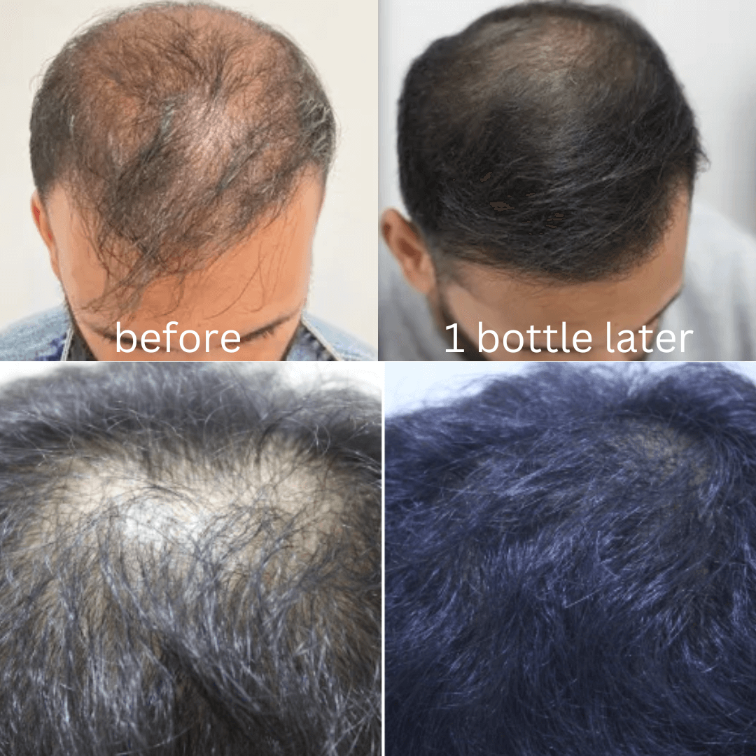 Onion Hair care kit | 3 Products | Glam X Beauty